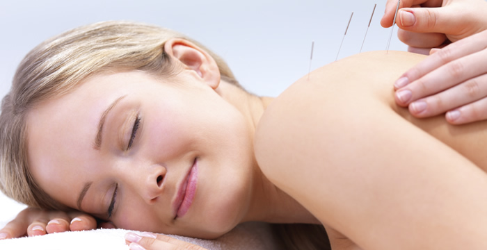 Acupuncture Harrogate