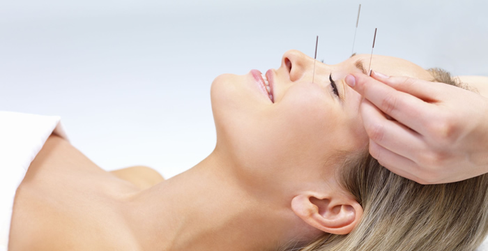 Acupuncture Harrogate