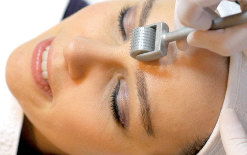 Derma Rollers Harrogate