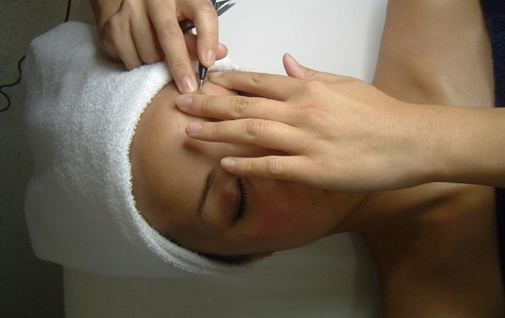 Electrolysis Diathermy Harrogate